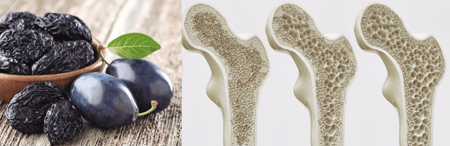 プルーンで骨を守る キレーション治療 療法 アンチエイジング治療は満尾クリニック